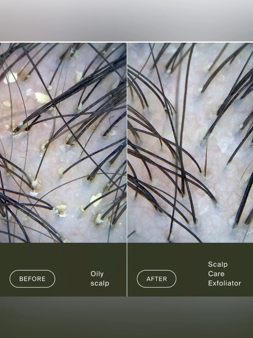 Living Proof Scalp Care Exfoliator